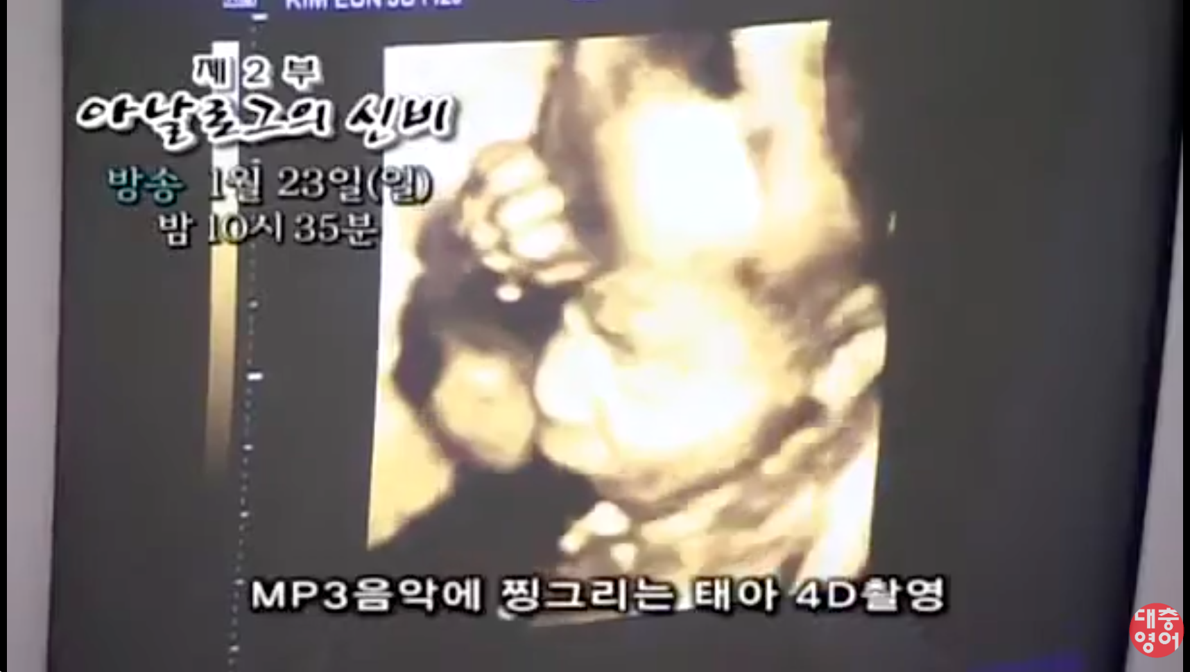 MBC 태아 MP3 거부 반응